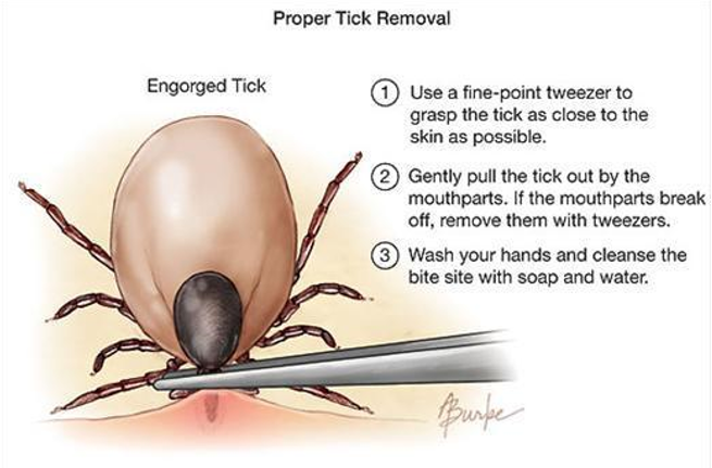 A graphic showing the removal steps listed in the article